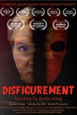 Disfigurement