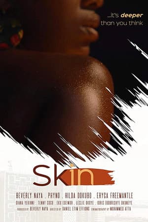 Skin